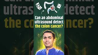 Can an abdominal ultrasound detect the colon cancer?