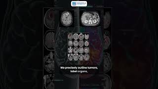 From #pixels to #precision : How #pareidolia Transforms Medical Scans into AI-Ready Data