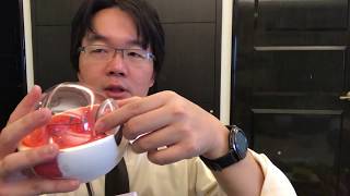 白內障手術後出現「飛蚊症」? 多久需檢查一次「飛蚊症」?  ─iDr.Shen沈筠惇醫師眼科衛教頻道