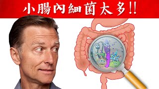 【消化】脹氣腹痛、缺營養是小腸細菌太多，偷走體內營養， 大腸小腸消化自然療法,柏格醫生 Dr Berg