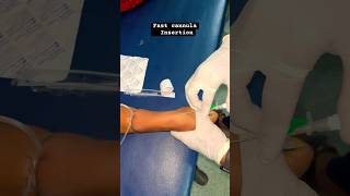 Fast cannula insertion #trending #apnabanaleremix #ivcannulation #trendingshorts #doctor #trendingsh
