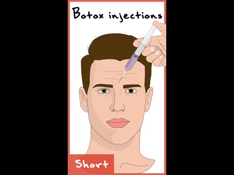 Botox Injections Explained | #shorts