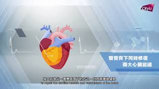 首創雙幹細胞療法 為心臟修復帶來曙光 First dual stem cell therapy brings new hope for cardiac repair
