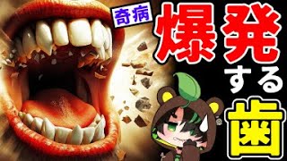【実話】歯が爆発する病気【閲覧注意】(奇病シリーズ)