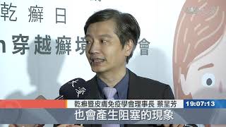 世界乾癬日─別隨意停藥 體內還沒好