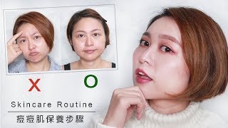 混合肌變痘痘肌？我的痘痘肌保養步驟 My Skincare Routine｜IMPearl 粉圓