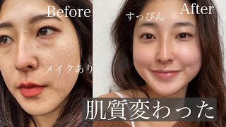 [Skin care to improve skin quality] My uneven skin quality has seriously changed. Try it out.