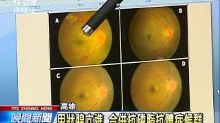 20歲女性無三高病史 竟罹眼中風 20141118 公視晚間