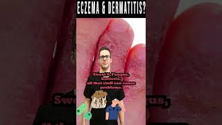 Dermatitis & Eczema: Dry, Itchy Skin or Rash not Better?