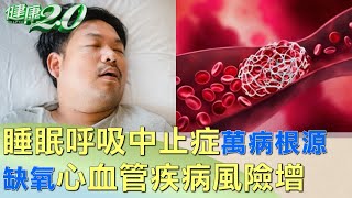 睡眠呼吸中止症萬病根源 缺氧心血管疾病風險增 健康2.0