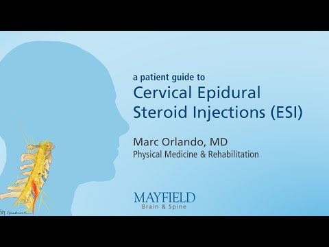 Cervical Epidural Steroid Injection