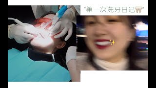 牙齿护理vlog | 体验人生中第一次洗牙！洗牙科普向
