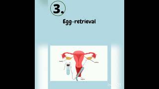 What are the five stages of IVF ? #ivf #ivfsuccess #ivfindia
