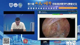 手術視頻轉播｜秦錦龍教授－腹腔鏡子宮內膜癌 ICG前哨淋巴結示蹤切除