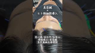 #高松市 #骨盤矯正 #美容鍼 #むくみ #たるみ #シワ #肌質改善 #ニキビ