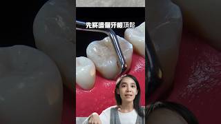 只需5秒鐘的拔牙#拔牙動畫#4k拔牙