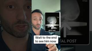 This is miraculous 😳. #shocking #creepy #medical #science #medtok #doctor #miracle