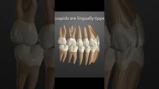Straightening your teeth can cause jaw pain.  #tmdtreatment #jawjoints #tmd #dentist