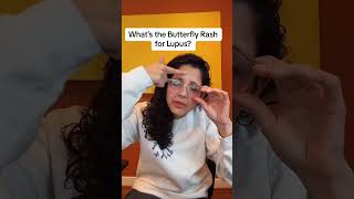What is the Lupus butterfly rash or malar rash?