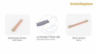ACL Reconstruction BTB Graft Preparation using adjustable button fixation surgical animation