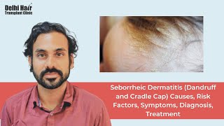 Seborrheic Dermatitis (Dandruff and Cradle Cap) Causes, Risk Factors, Symptoms, Diagnosis, Treatment