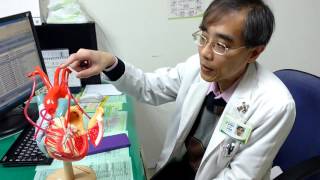 心房顫動 容易產生血栓