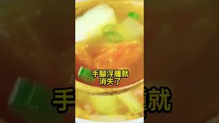 經典醫術百病食療大全通俗易懂，對症食療祛百病跟著學會吃這些，少往醫院跑