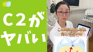 【実はヤバイ虫歯】歯科健診のＣ１、Ｃ２