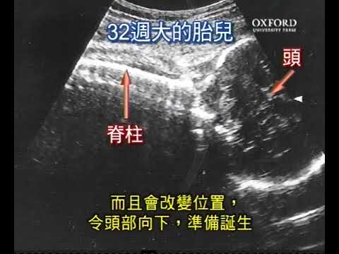 影片13.1 檢視胎兒在不同階段的成長過程