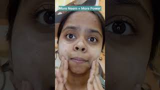 Best face wash for teenagers#himalayaneemfacewash #pimplecare #facewash #teenagers #saferskincare