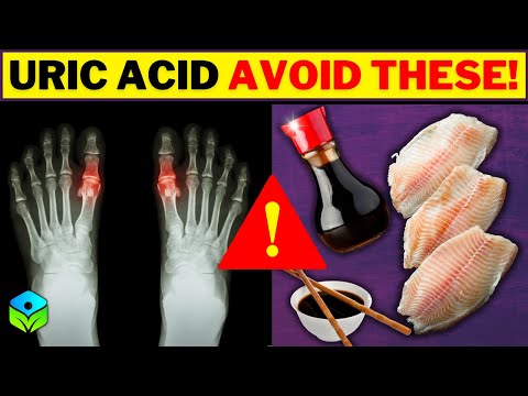 GOUT? Uric Acid Foods to AVOID