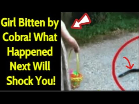 Girl Bitten by Cobra! What Happened Next Will Shock You! #truestory