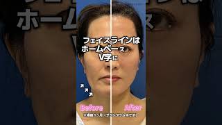マイナス10歳！最強のアンチエイジング！#shorts