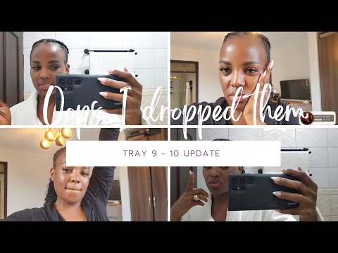 VLOG// MY ALIGNERS ENDED UP IN THE BIN 🤭 |TRAY 9 - 10 UPDATE