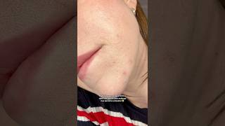 #badmakeup #disastermakeup #baddaymakeup #acne #acneskin #dryskin
