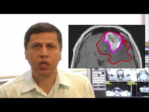 Segasist Cloud for Quality Assurance in Cancer Radiation Therapy