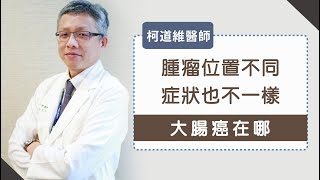 《大腸癌在哪》腫瘤位置不同、症狀也不一樣-柯道維醫師