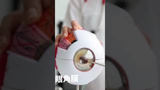 ⚠️散光度數有可能是角膜病變的前兆