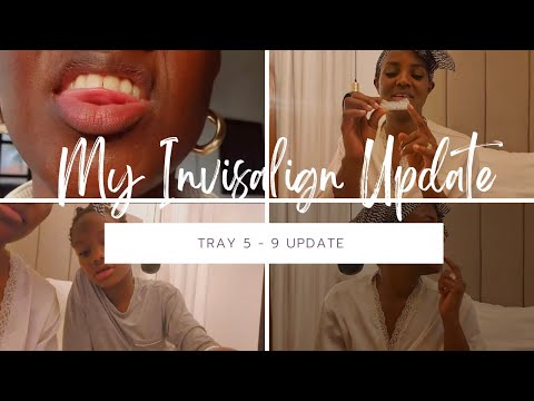 VLOG// MY INVISALIGN EXPERIENCE TRAY 5 - 9 UPDATE| STRUGGLES & TRIUMPHS with URIEL DENTAL