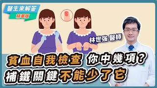【愛健康│醫生來解答】貧血自我檢查 你中幾項？補鐵關鍵不能少了它