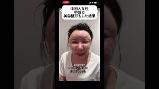 【うわ】中国国内の美容整形 #shorts