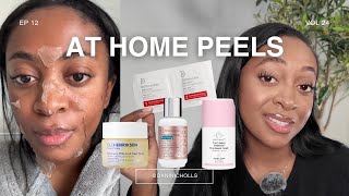 the best at home chemical peels | safe for dark skin ✨