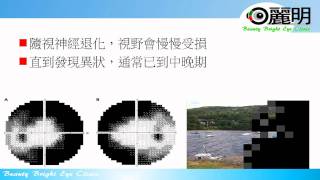 青光眼與眼壓