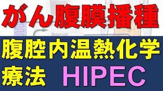 がんの腹膜播種に対する腹腔内温熱化学療法 (HIPEC)：卵巣癌での研究結果