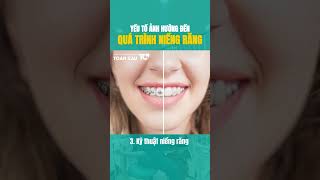 Yếu tố ảnh hưởng đến quá trình niềng răng #toancau #nhakhoathammytoancau #niengrang #niengrangmaccai