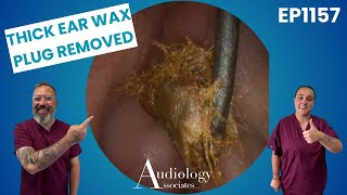 Three Surprising Ear Cleanings in One Video! - EP1157