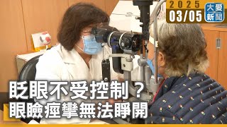 眨眼不受控制？ 眼瞼痙攣無法睜開｜大愛新聞 @DaaiWorldNews