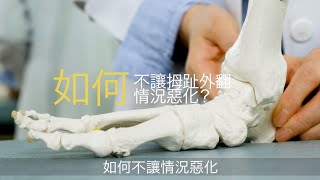 【#第15屆健康博覽．健康資訊站】如何不讓拇趾外翻情況惡化？