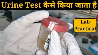 Urine Test Kaise Kiya Jata hai, Urine R/M (Routine and Microscopy), Urine Test Procedure & Report