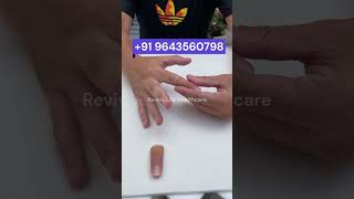 #9643560798  Best Silicone Finger #viralshorts #siliconeprosthesis